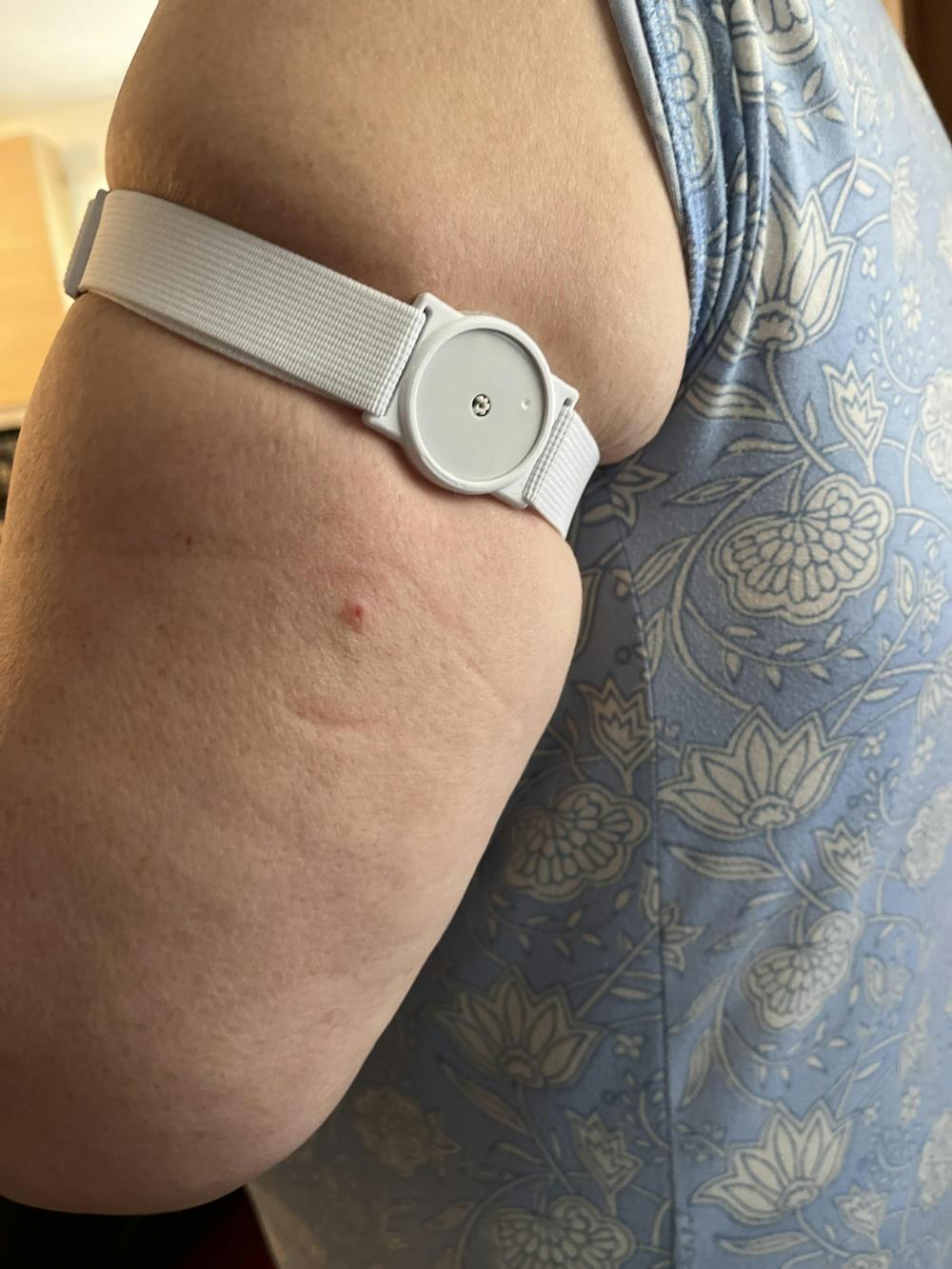 CGM Clips UK - Sensor Armband Holder/Protector Compatible with Freestyle Libre 1/2 - White