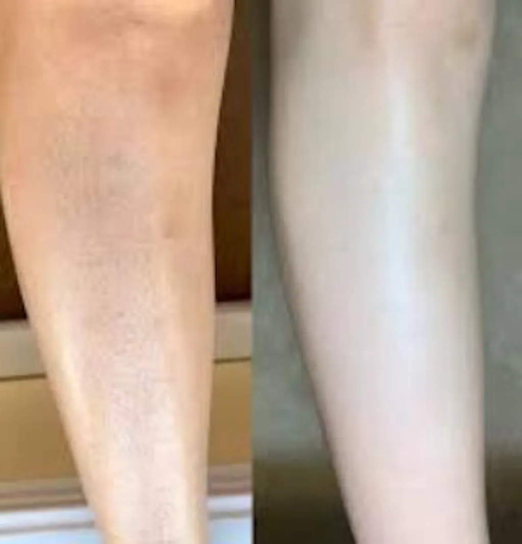 Sanfe Instant Tan Dead Skin Removal Exfoliating Gel 200g sanfe-instant-tan-dead-skin-removal-exfoliating-gel-200g
