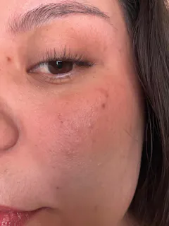 Review picture