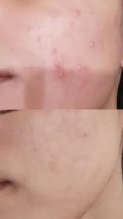 Review picture