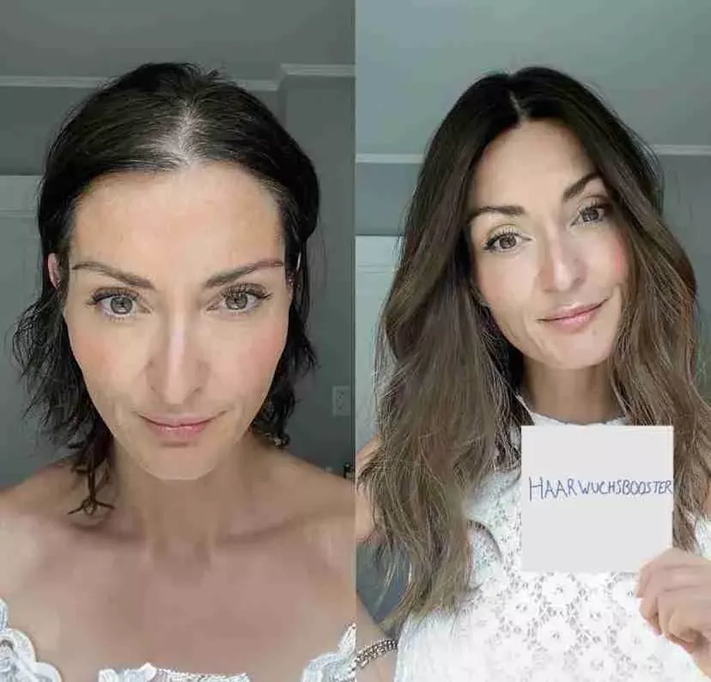 ShinyHair Haarwuchsbooster