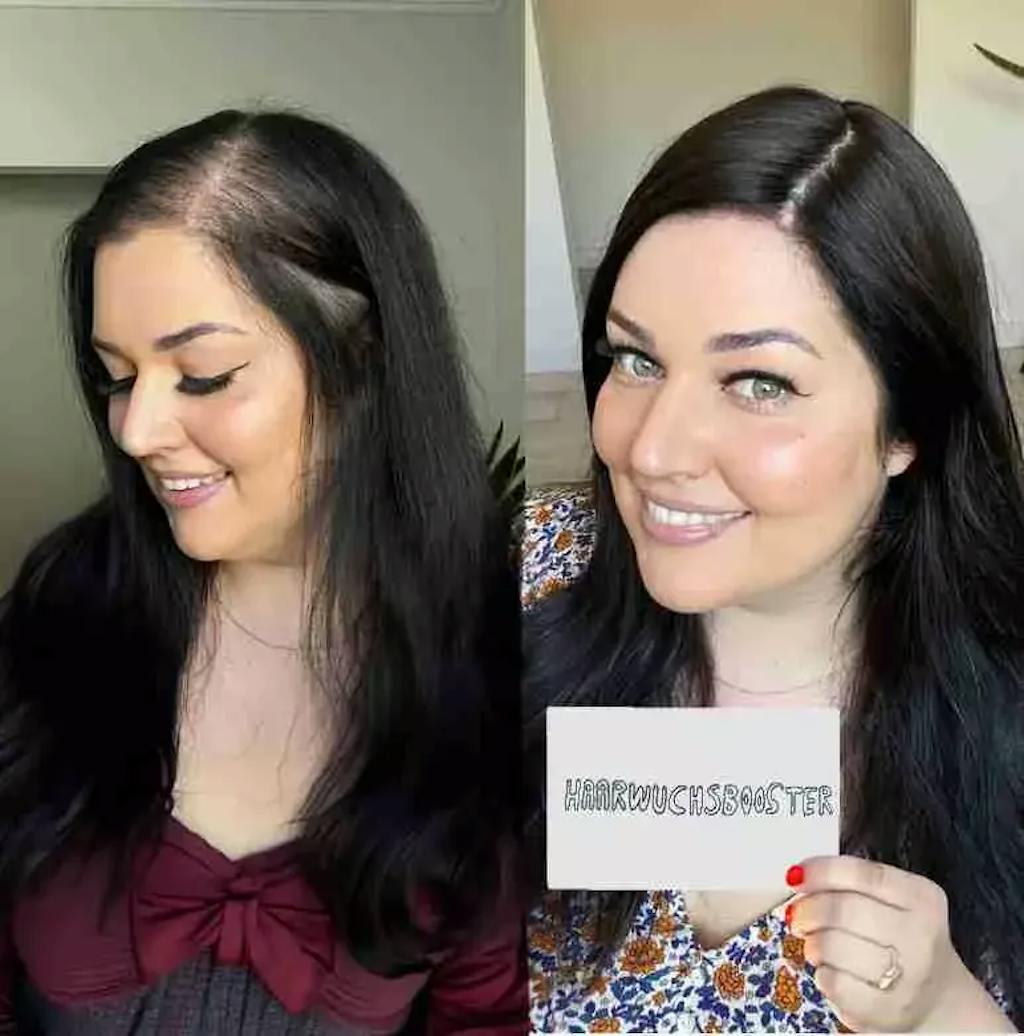 ShinyHair Haarwuchsbooster