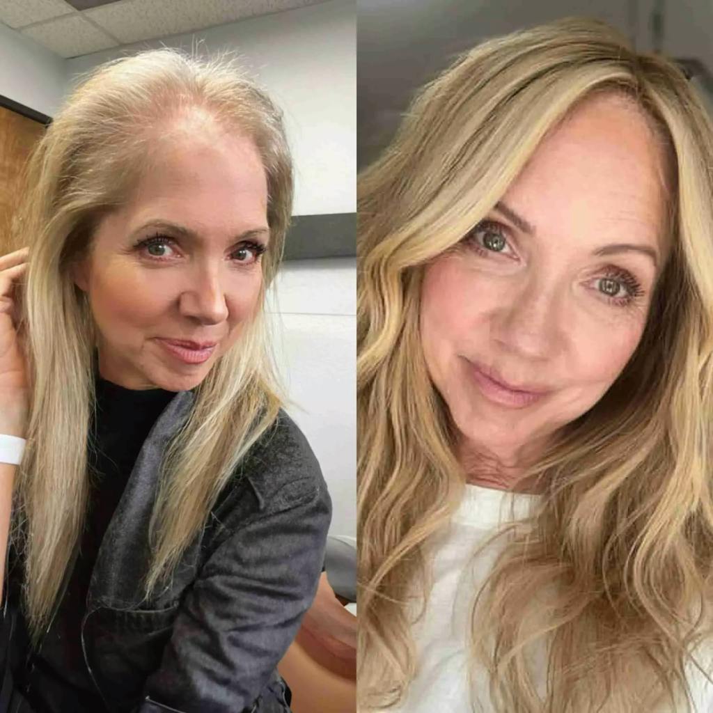 ShinyHair Haarwuchsbooster