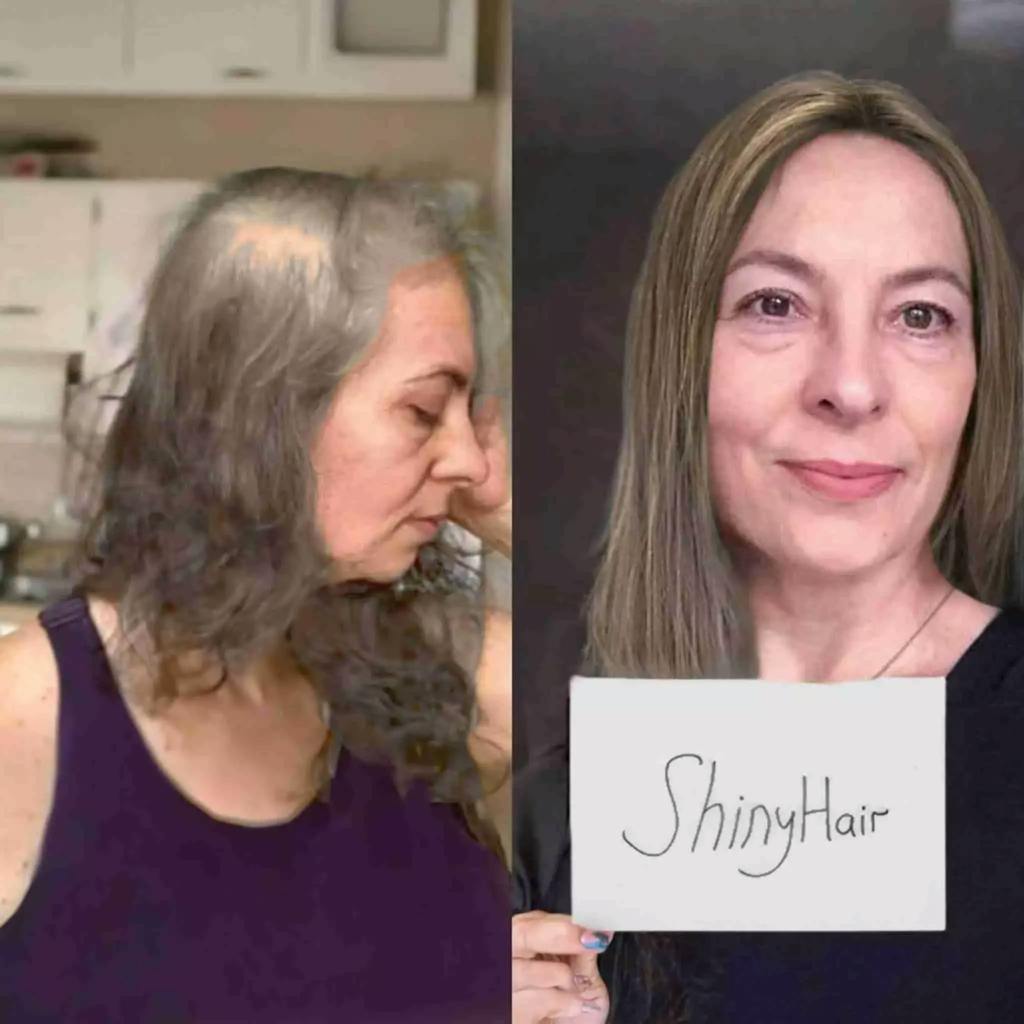 ShinyHair Haarwuchsbooster