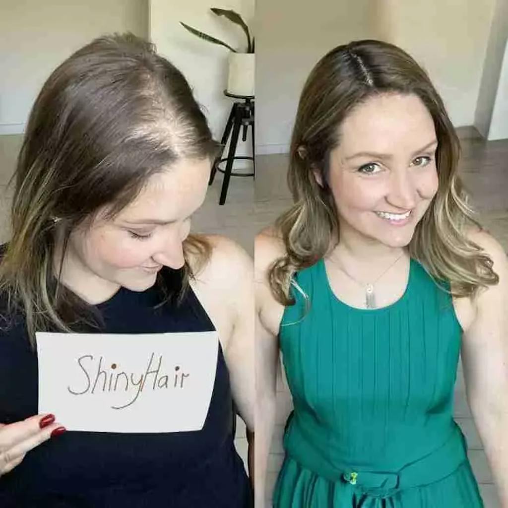 ShinyHair Haarwuchsbooster