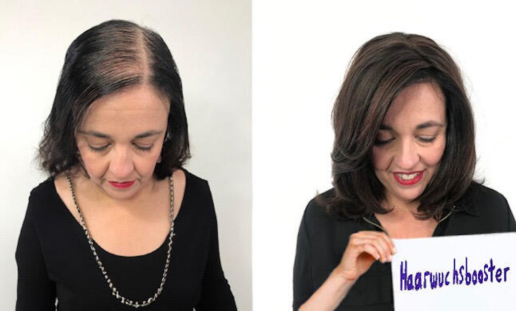 ShinyHair Haarwuchsbooster