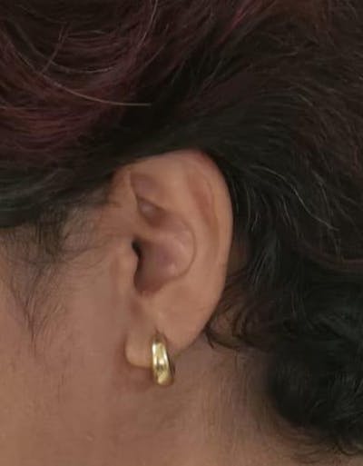 Classic Mini Huggies