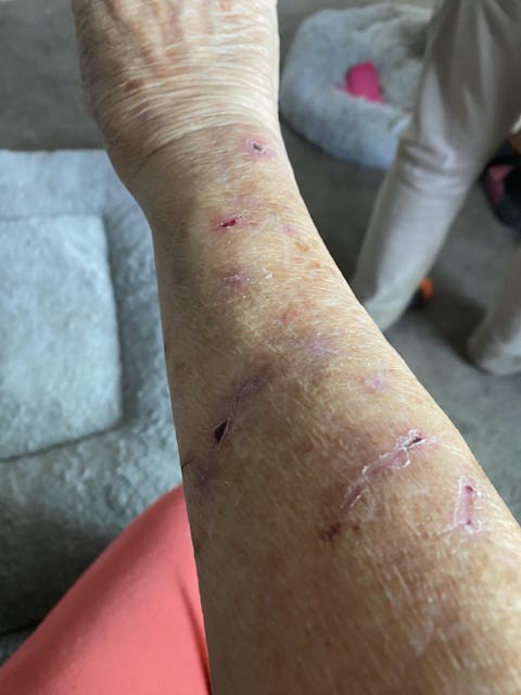 Rapid Wound Repair Ointment