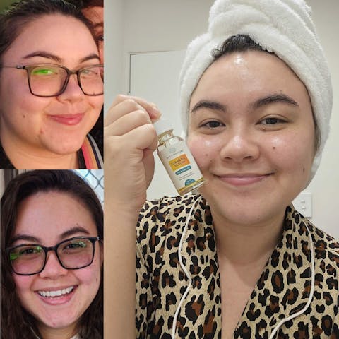 Turmeric Face Care Bundle