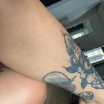 SHINE® IPL Laser Hair Remover