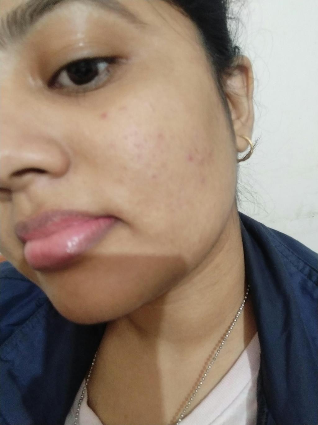 Top Rated Moisturizing Cleanser Online at Best Price SkinKraft