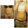 28 Day Ultimate Teatox
