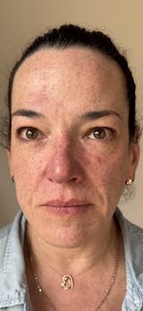 Rutina Completa con tu fórmula personalizada: contorno de ojos, serum, crema de día, crema de noche