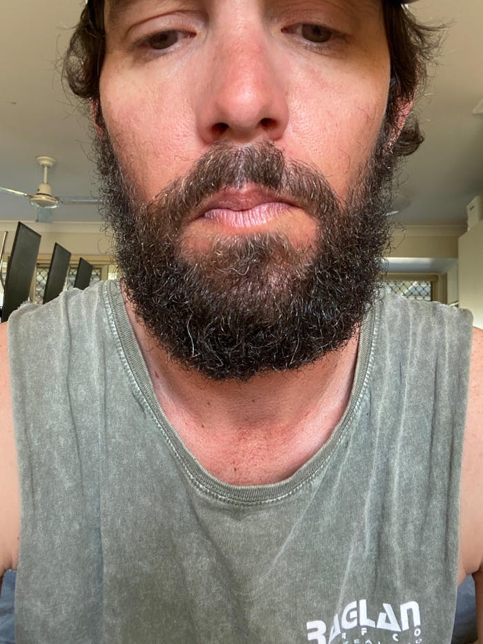 Better Beard Kit (Beard Growth Kit Included)