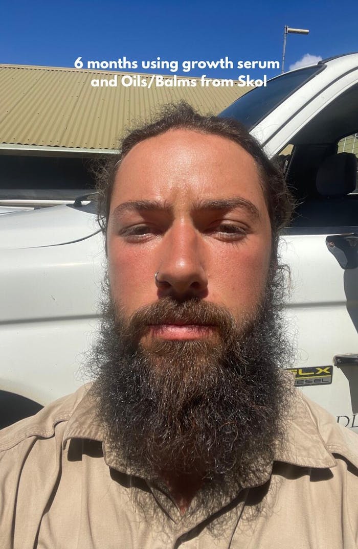 Skol's 'Black Oudh' Beard Care - Rich Oudh Wood, Sweet Florals *Luxury, Woodsy Cologne