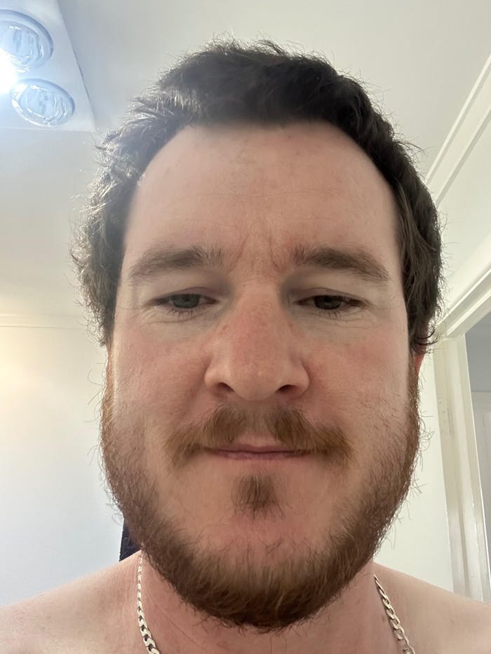 Better Beard Kit (Beard Growth Kit Included)