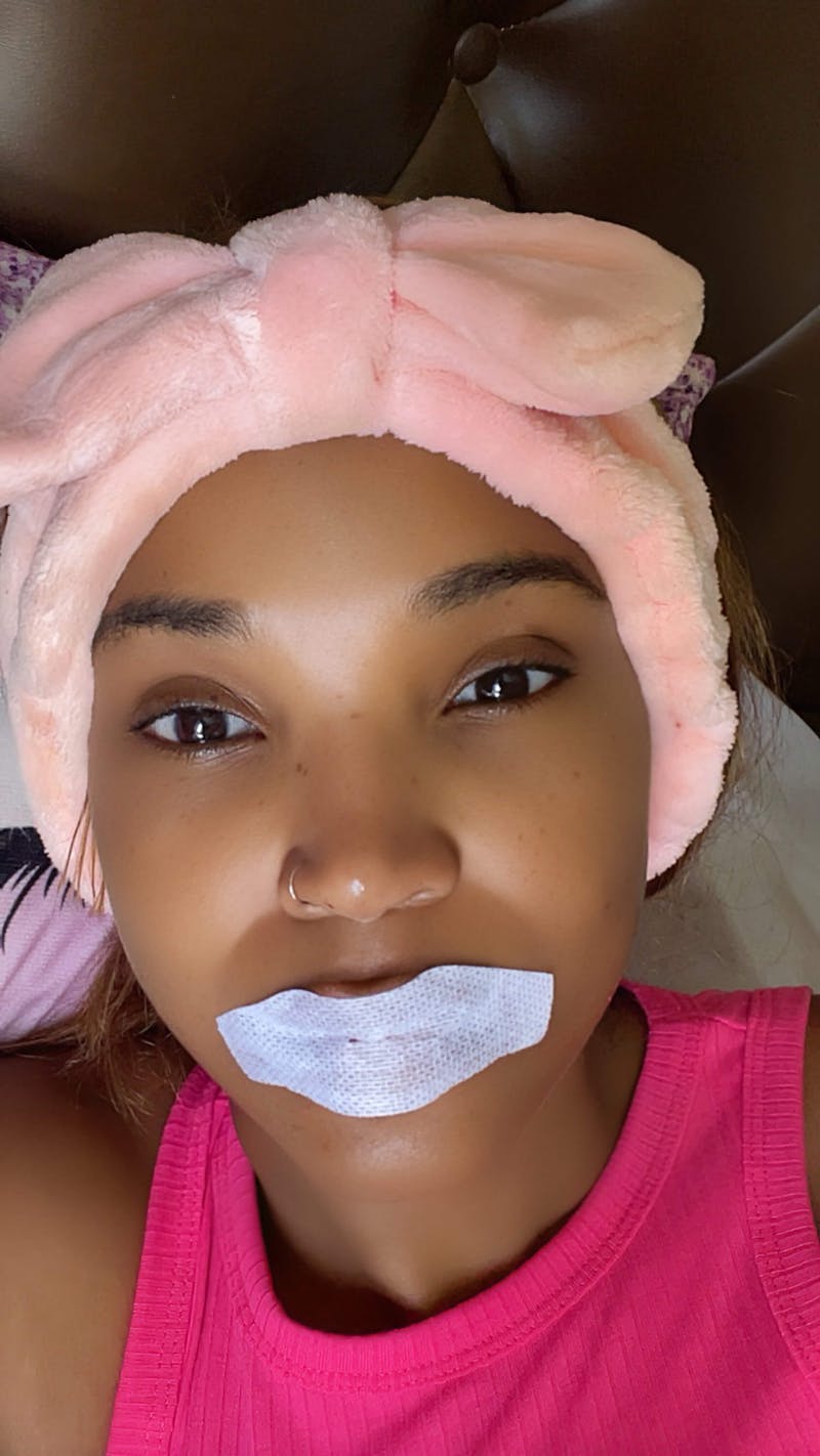 Sleepnotize Premium Mouth Tape