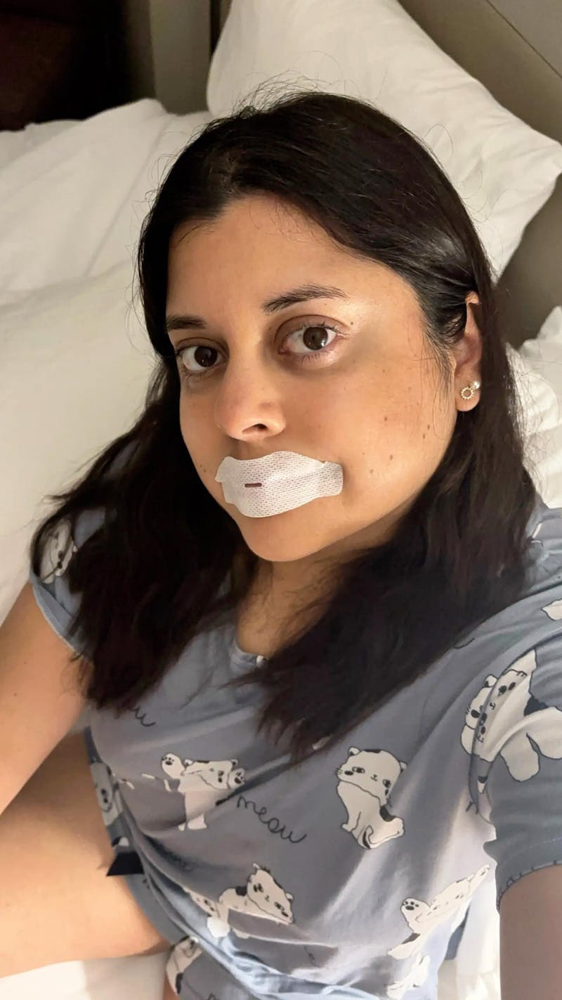 Sleepnotize Premium Mouth Tape