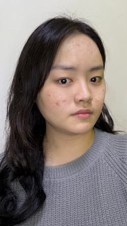 Azulene Spot Control Quota Pad