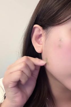 Cica Bio Spot Control Patch