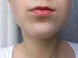 Vitamina C Lip Scrub Lotion