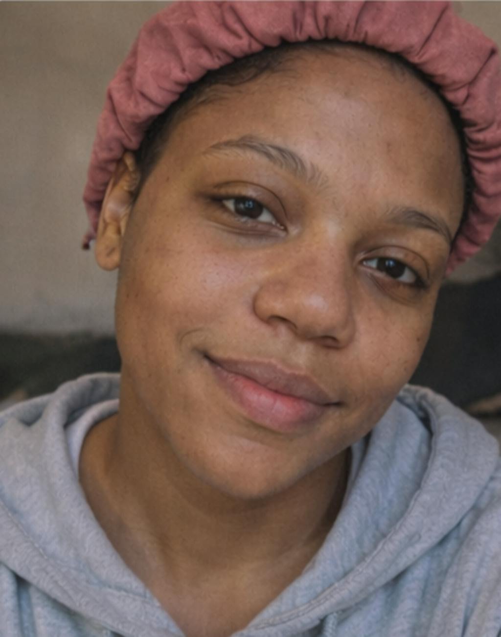 Marre des taches qui restent des semaines sur votre peau ?