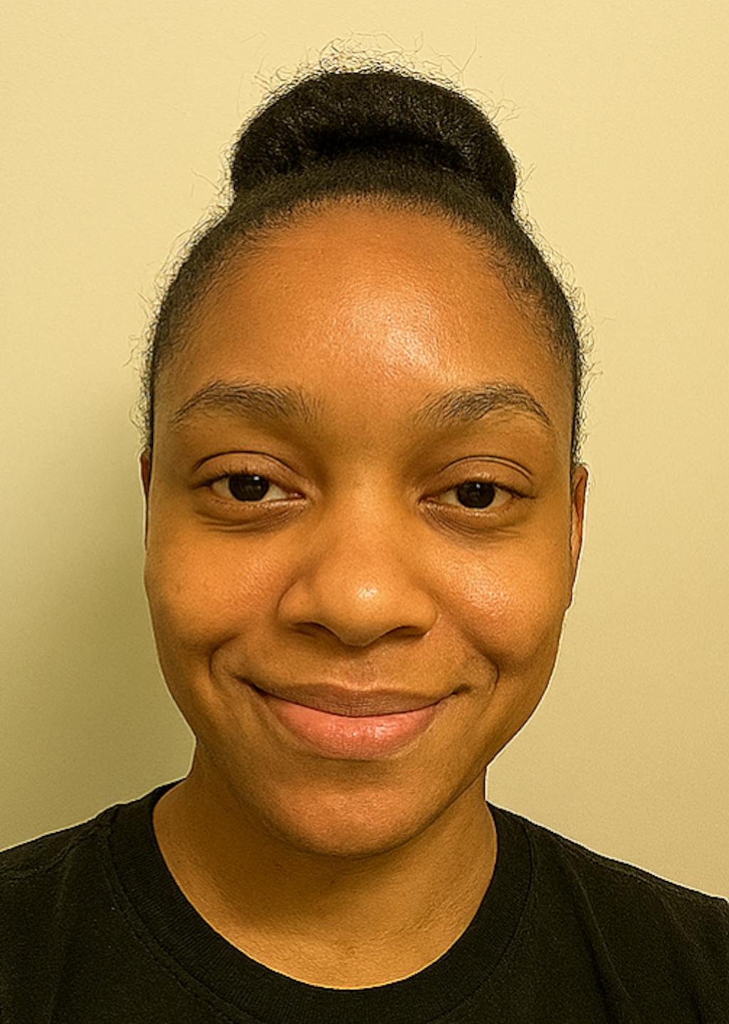 Marre des taches qui restent des semaines sur votre peau ?