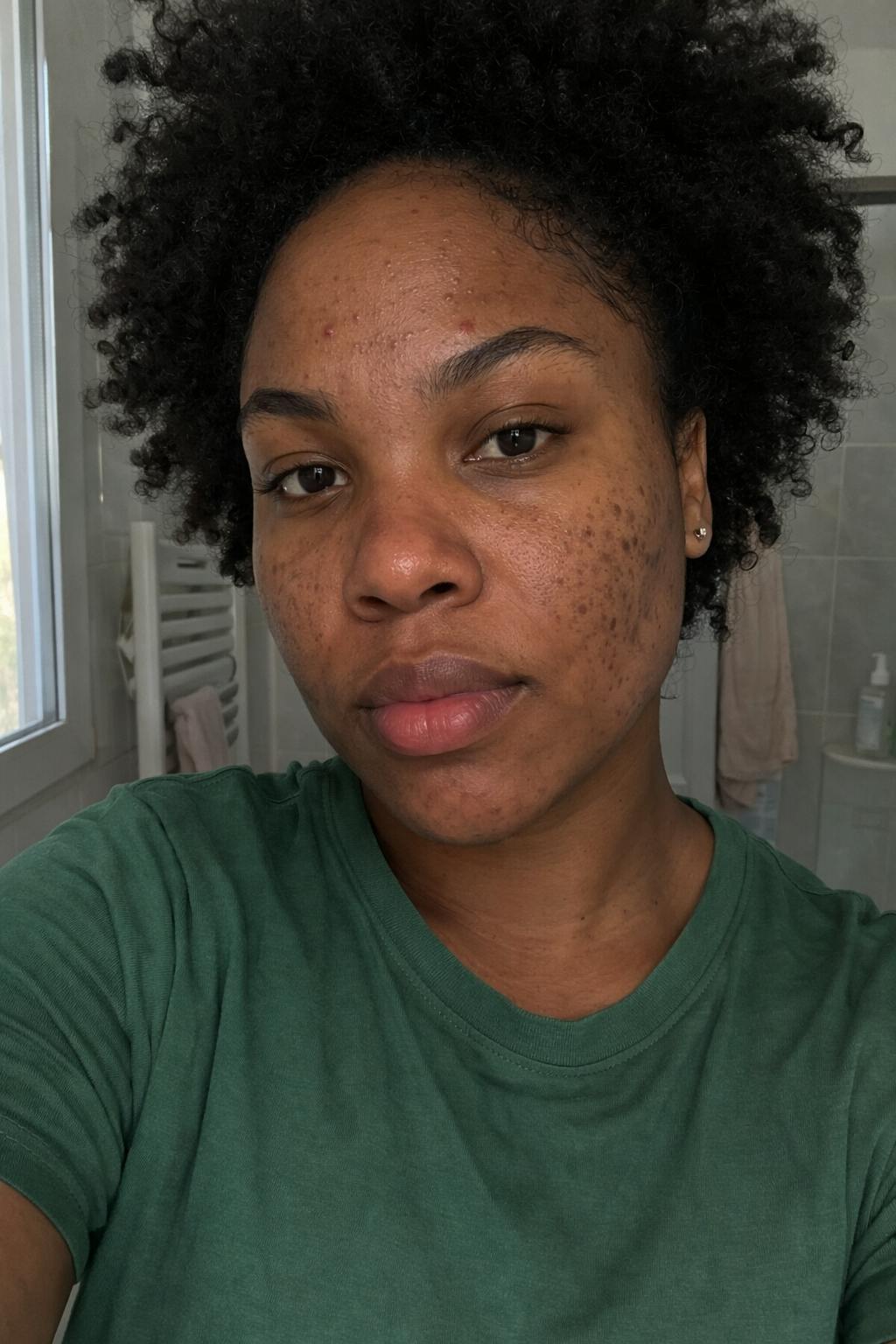 Marre des taches qui restent des semaines sur votre peau ?