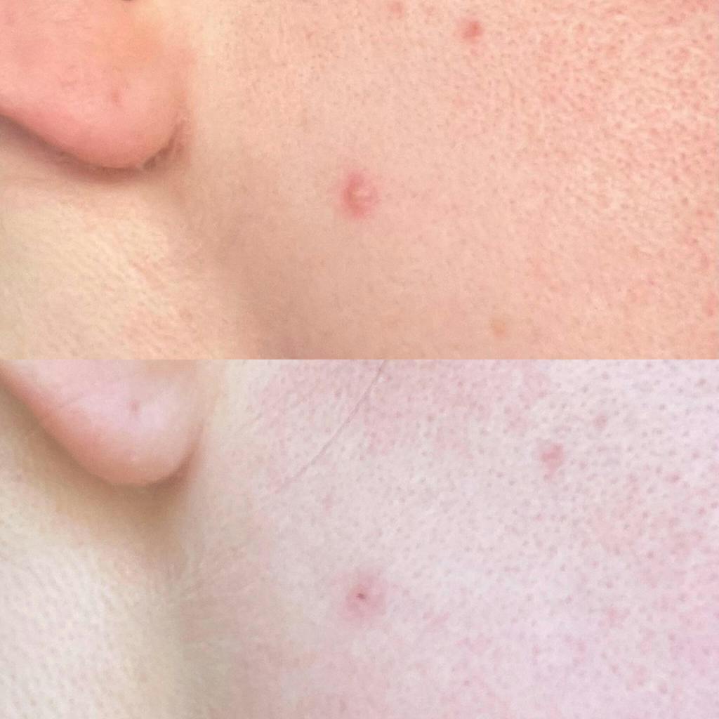 Hormonal Clear Concentrate