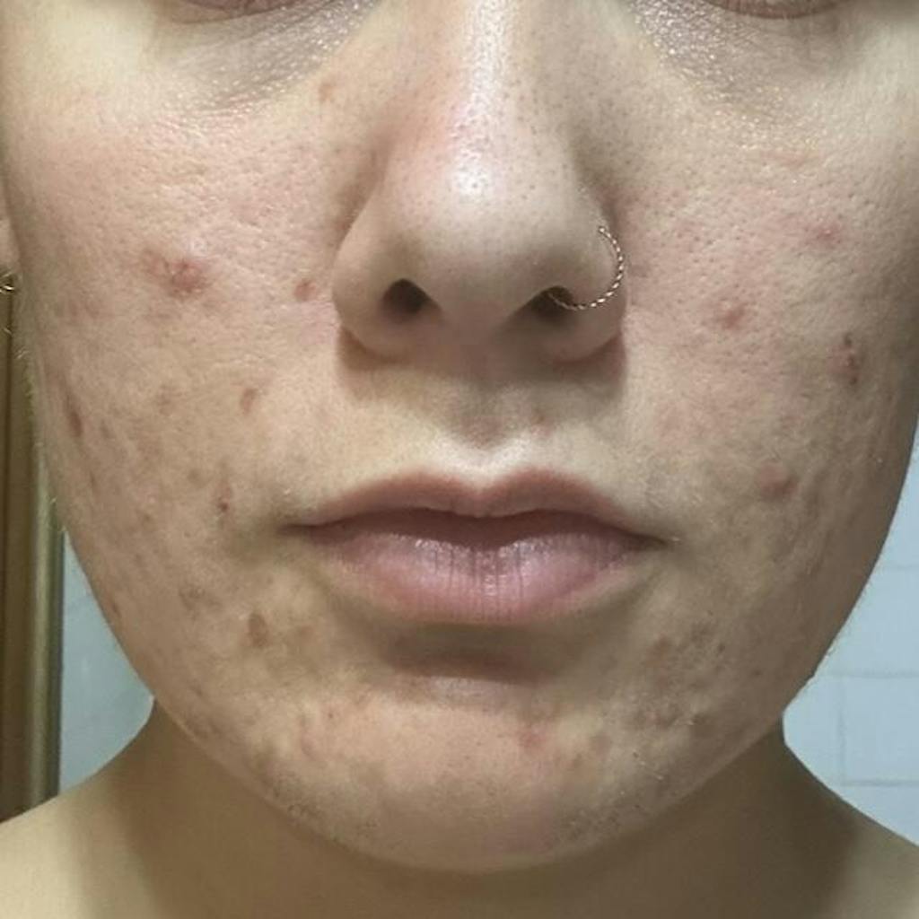 Hormonal Clear Concentrate