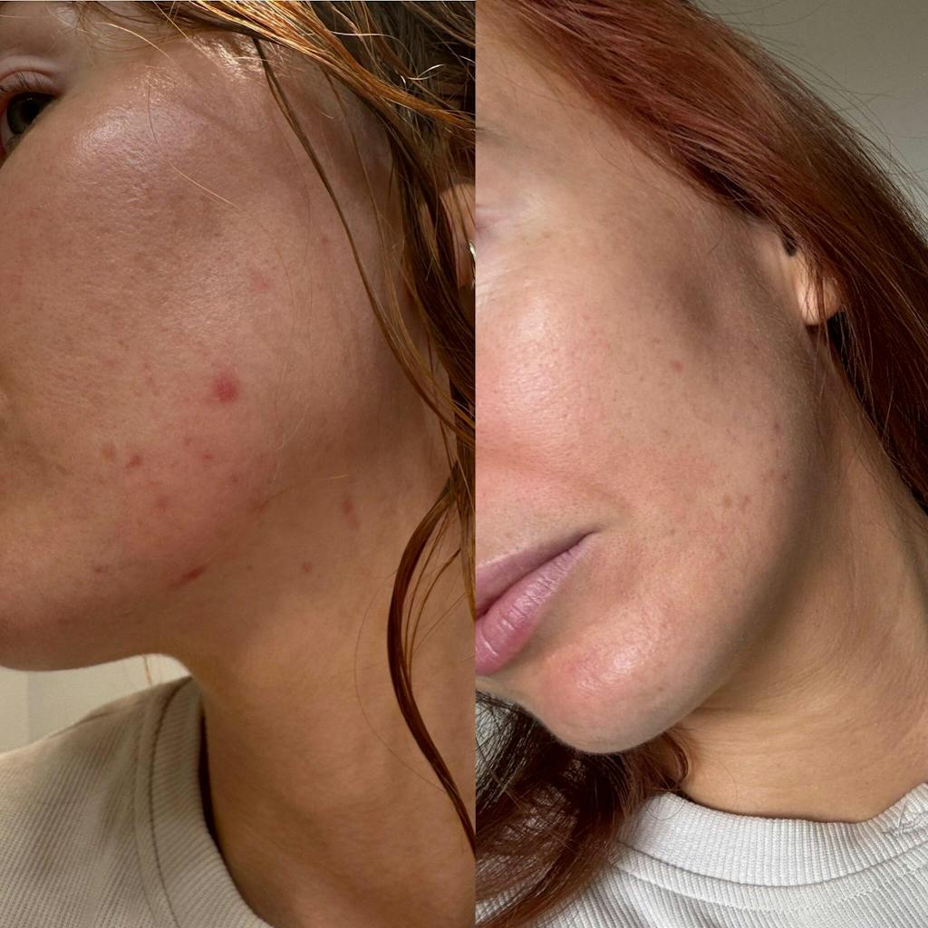 Hormonal Clear Concentrate