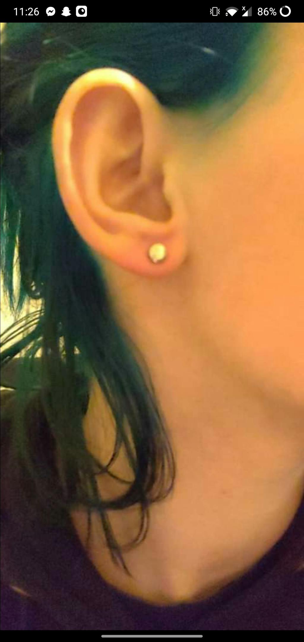 Dead Stretching Kit Ear Stretching Kit Stretch It Body Jewellery