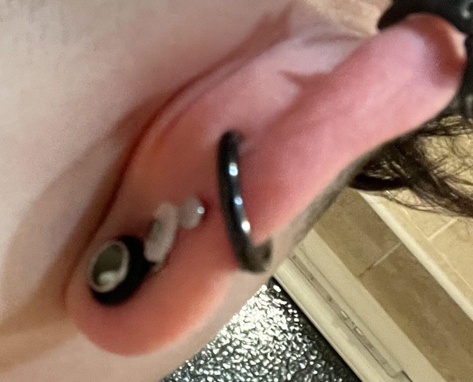 LobeLove™ Piercing Disc Nose Piercing Bump Piercing Keloid Disc