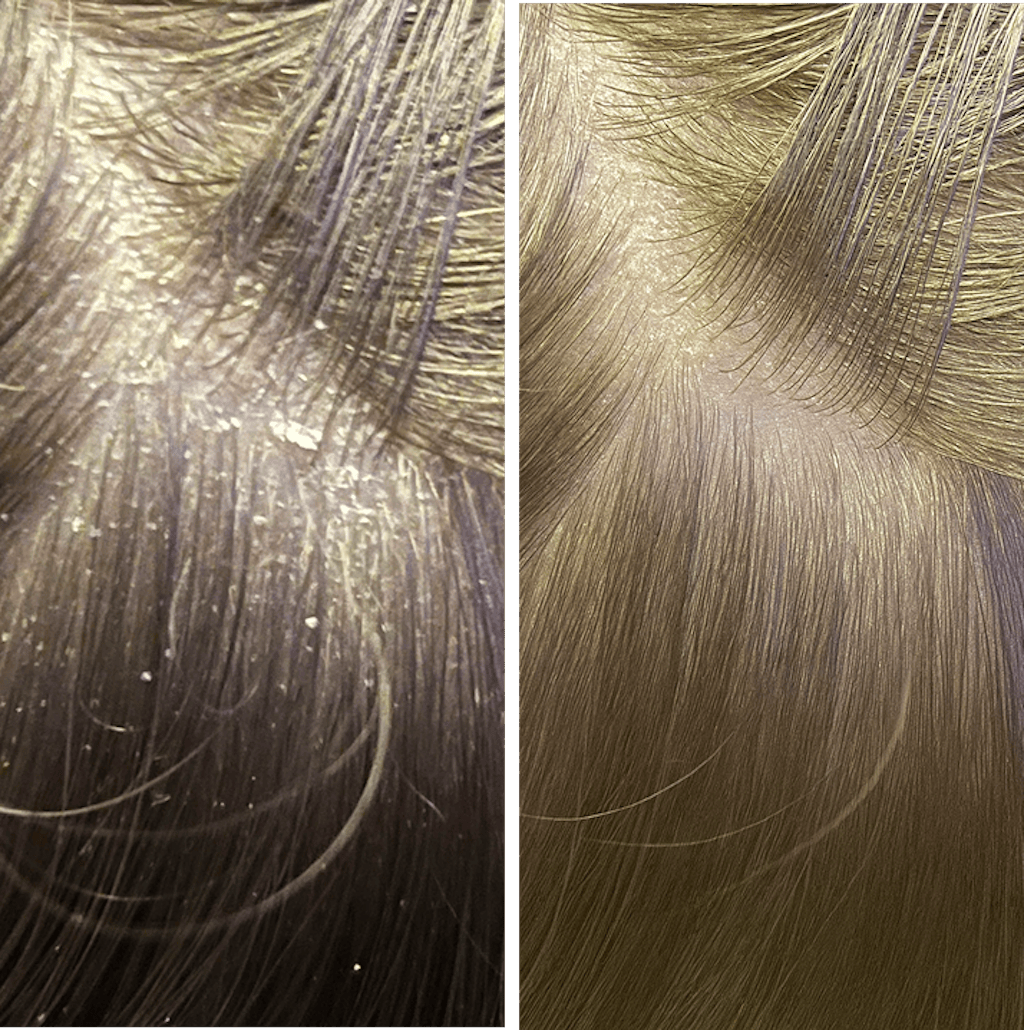 Root Resetter Scalp Scrub™