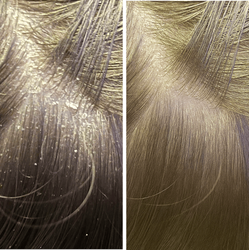 Root Resetter Scalp Scrub™