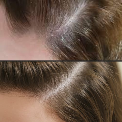 Root Resetter Scalp Scrub™