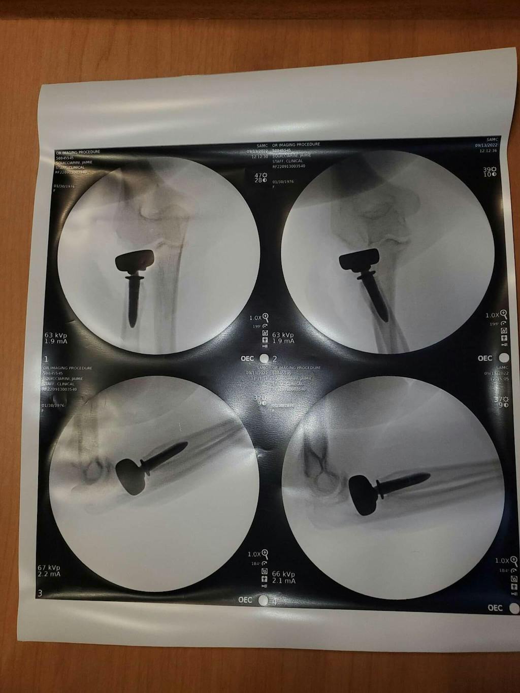 Aircast® Cryo Cuff Replacement Wraps by Aircast from 68.99 at Supply ...