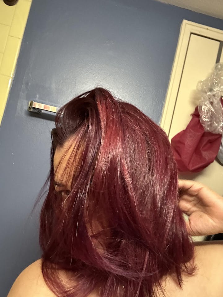 Dandruff & Oil control Kit With Scalp Oil