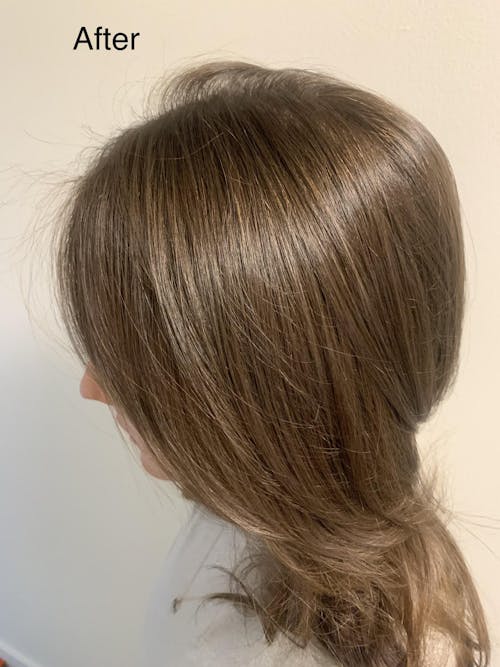 Sensitive Scalp Shampoo