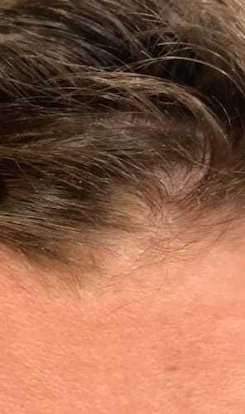 Sensitive Scalp Shampoo