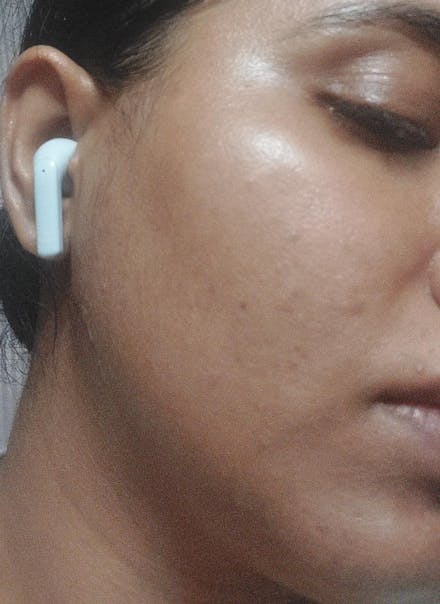 Rapid Clear Facewash