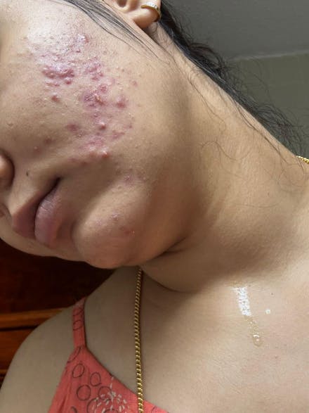 Barrier Repair Gel Moisturiser