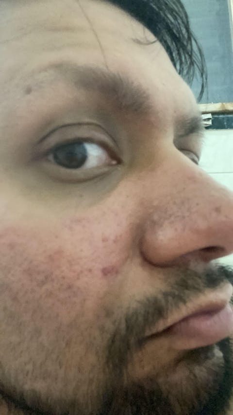 Barrier Repair Gel Moisturiser