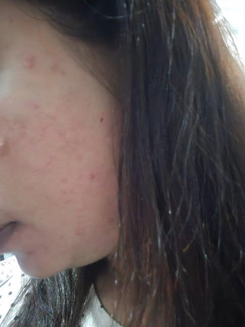 Rapid Clear Facewash