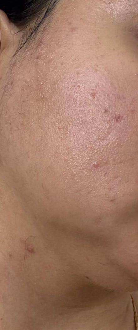 Spot Fade Advanced Repair Serum