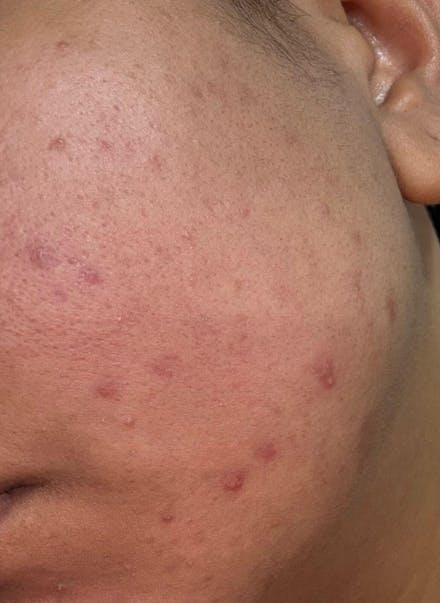 Barrier Repair Gel Moisturiser