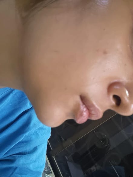 Rapid Clear Facewash