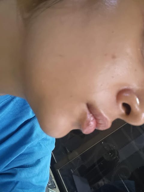 Rapid Clear Facewash