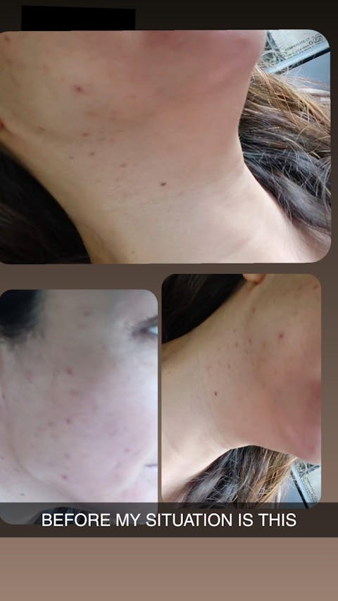 Spot Fade Advanced Repair Serum