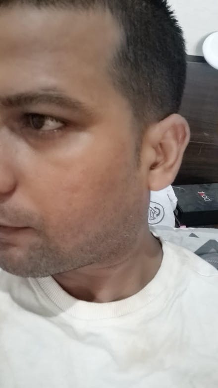 Rapid Clear Facewash